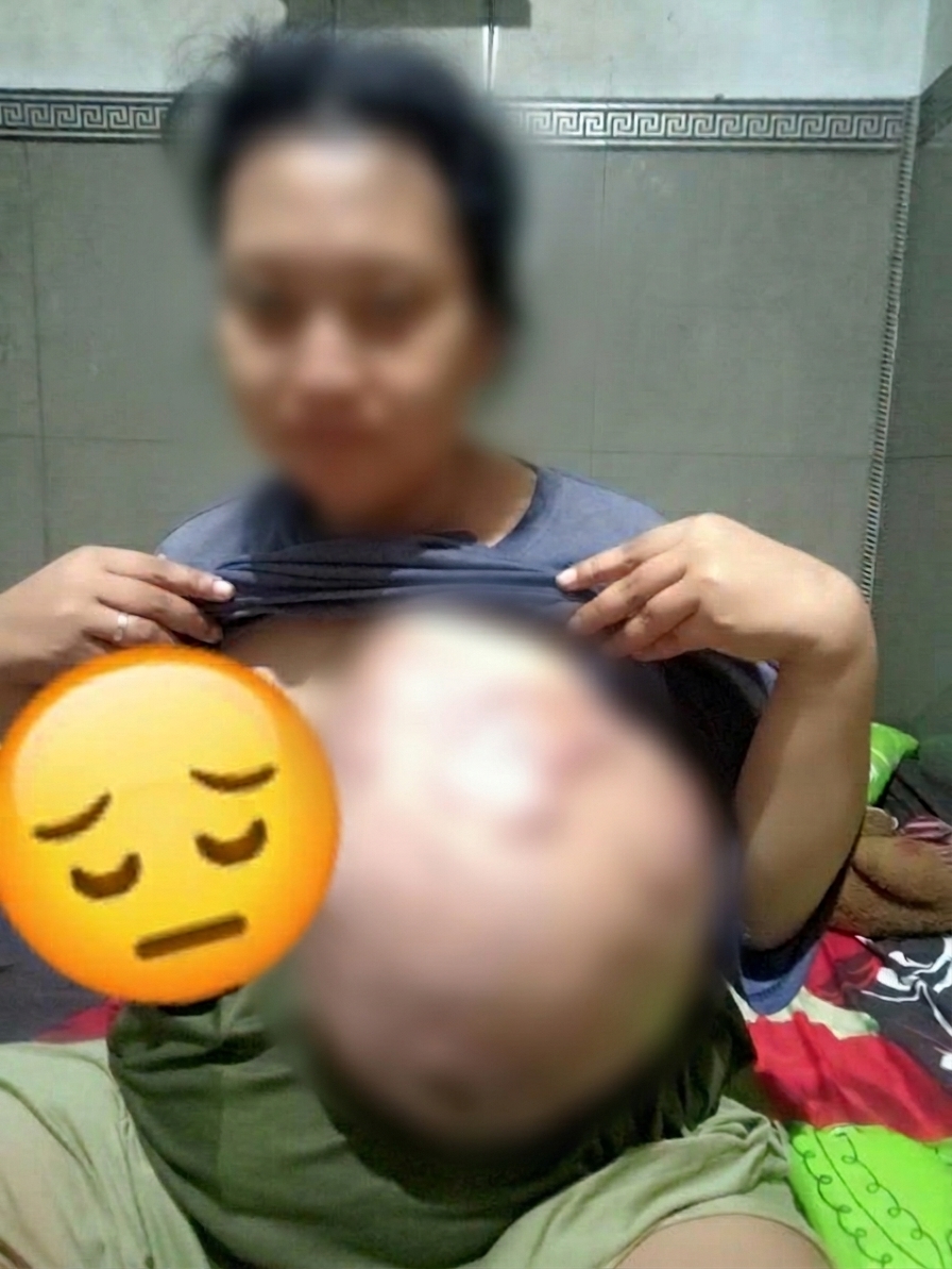 Relawan LSM CBN Nganjuk Perjuangkan Janda Penderita Tumor Dapat Tindakan Medis 2 CBN Tumor Blur